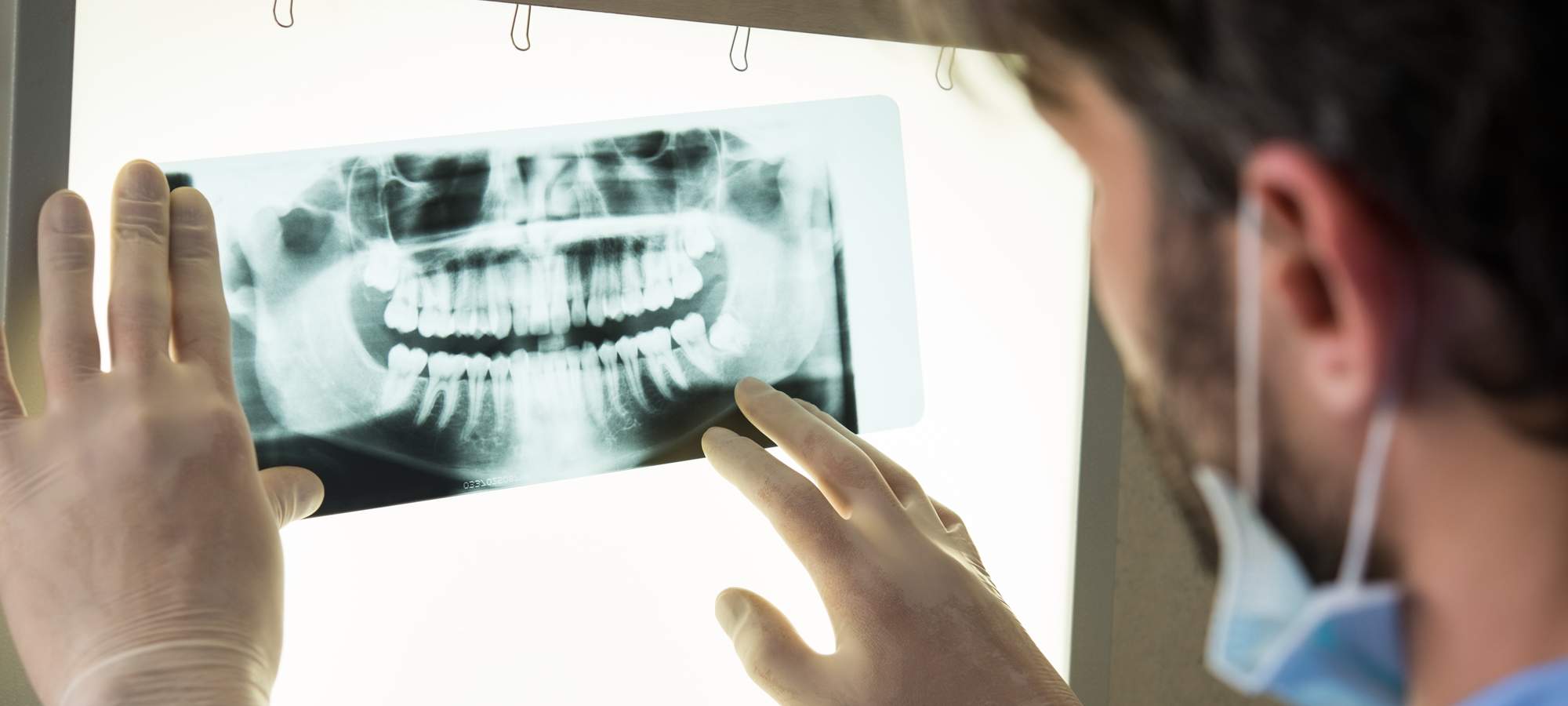 Oral Surgery Cincinnati OH, Oral Surgery